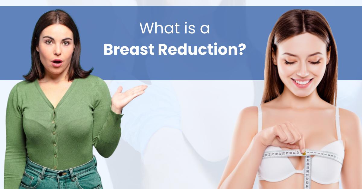 What is a Breast Reduction